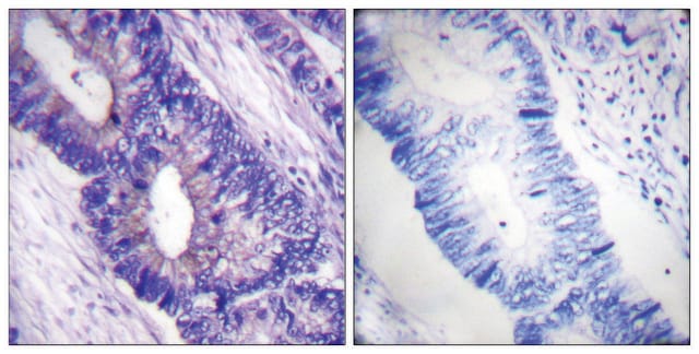 Anti-phospho-PKA &#945;/&#946; CAT (pThr197) antibody produced in rabbit affinity isolated antibody