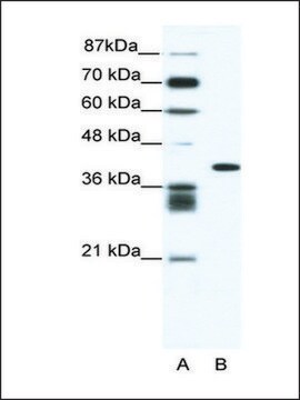 Anti-ALX4 (AB2) antibody produced in rabbit affinity isolated antibody