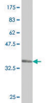 Monoclonal Anti-WDR36 antibody produced in mouse clone 1D6, purified immunoglobulin, buffered aqueous solution