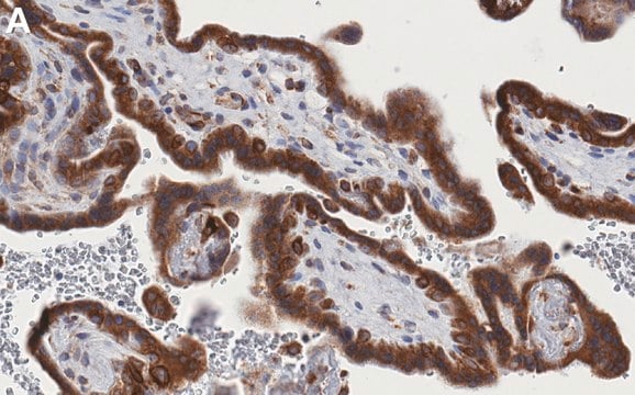 Anti-ACSL3 Antibody, clone 1I18 ZooMAb&#174; Rabbit Monoclonal recombinant, expressed in HEK 293 cells