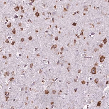 Anti-RPL29 antibody produced in rabbit Prestige Antibodies&#174; Powered by Atlas Antibodies, affinity isolated antibody, buffered aqueous glycerol solution