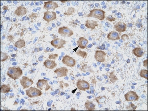 Anti-TNFRSF18 antibody produced in rabbit affinity isolated antibody