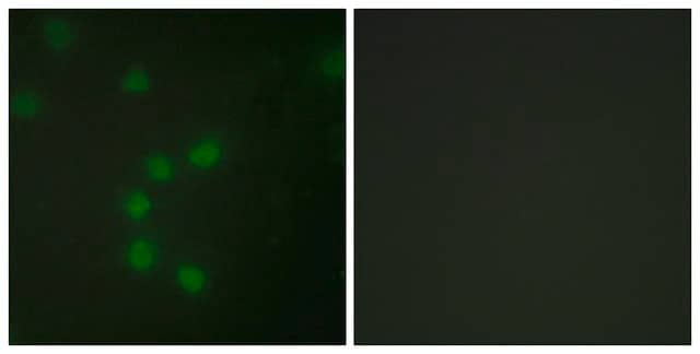 Anti-Telomerase antibody produced in rabbit affinity isolated antibody