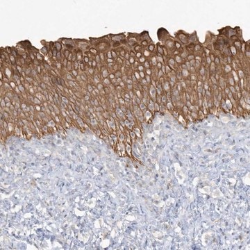 Anti-LARS antibody produced in rabbit Prestige Antibodies&#174; Powered by Atlas Antibodies, affinity isolated antibody, buffered aqueous glycerol solution