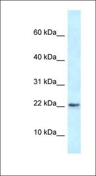 Anti-RBM3 antibody produced in rabbit affinity isolated antibody