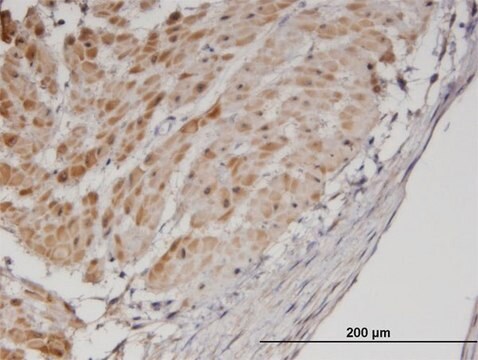 Monoclonal Anti-TPM3 antibody produced in mouse clone 2E4, purified immunoglobulin, buffered aqueous solution