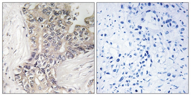 Anti-B3GALTL antibody produced in rabbit affinity isolated antibody