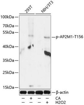 Anti-Phospho-AP2M1-T156 antibody produced in rabbit