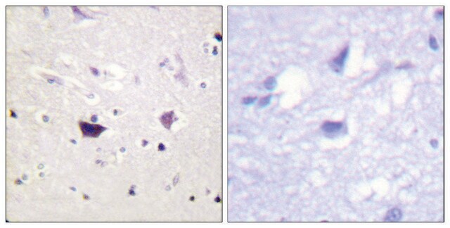 Anti-PAK1 antibody produced in rabbit affinity isolated antibody