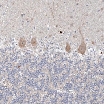 Anti-SDAD1 antibody produced in rabbit Prestige Antibodies&#174; Powered by Atlas Antibodies, affinity isolated antibody, buffered aqueous glycerol solution