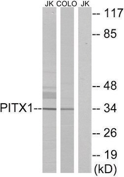 Anti-PITX1 antibody produced in rabbit affinity isolated antibody