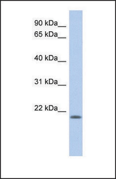 Anti-CHAC2, (N-terminal) antibody produced in rabbit affinity isolated antibody