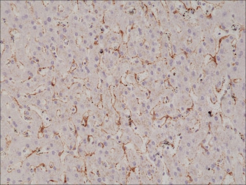 Anti-Caveolin-1 antibody, Rabbit monoclonal recombinant, expressed in HEK 293 cells, clone RM325, purified immunoglobulin