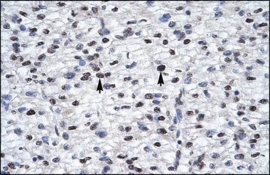 Anti-GLI2 IgG fraction of antiserum