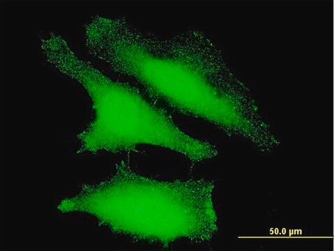 ANTI-FOXO1A antibody produced in mouse clone 4A2, purified immunoglobulin, buffered aqueous solution