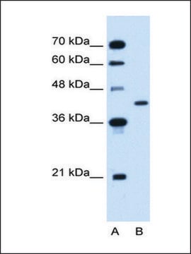 Anti-GOT2 (AB1) antibody produced in rabbit IgG fraction of antiserum