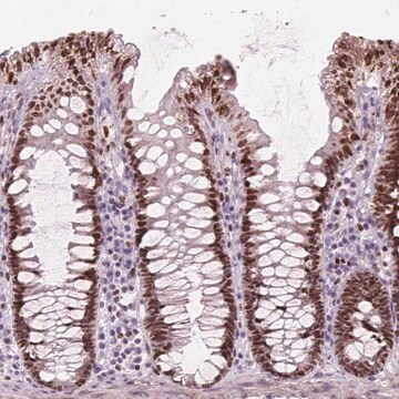 Anti-ISLR2 antibody produced in rabbit Prestige Antibodies&#174; Powered by Atlas Antibodies, affinity isolated antibody, buffered aqueous glycerol solution