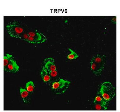 Anti-TRPV6 antibody produced in rabbit affinity isolated antibody