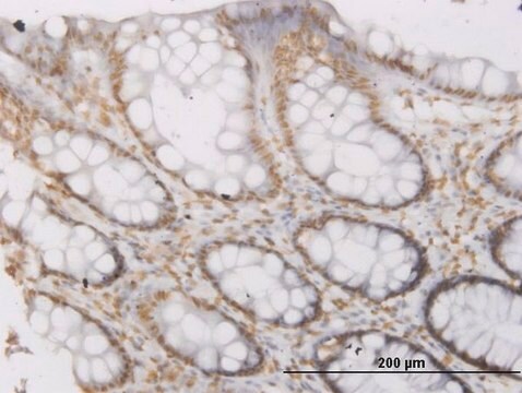 Monoclonal Anti-ROPN1 antibody produced in mouse clone 4E11, purified immunoglobulin, buffered aqueous solution