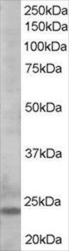 Anti-BIM (AD/ACD/ABCD Isoforms) antibody produced in goat affinity isolated antibody, buffered aqueous solution