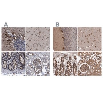 Anti-DARS antibody produced in rabbit Prestige Antibodies&#174; Powered by Atlas Antibodies, affinity isolated antibody, buffered aqueous glycerol solution, Ab1