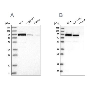 Anti-FAM129B antibody produced in rabbit Prestige Antibodies&#174; Powered by Atlas Antibodies, affinity isolated antibody, buffered aqueous glycerol solution, Ab4