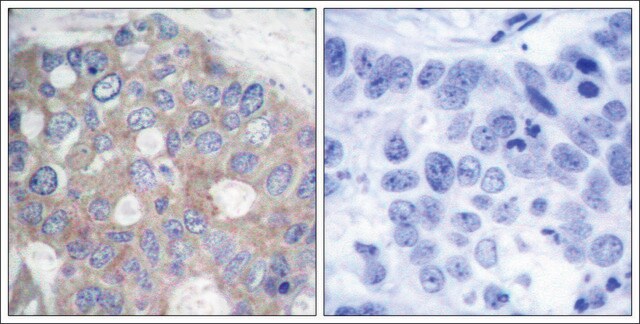 Anti-RPS6KB1 (Ab-421) antibody produced in rabbit affinity isolated antibody