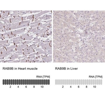 Anti-RAB9B antibody produced in rabbit Prestige Antibodies&#174; Powered by Atlas Antibodies, affinity isolated antibody, buffered aqueous glycerol solution