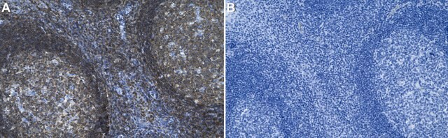 Anti-MST1/STK4 Antibody, clone 1L17-L2 ZooMAb&#174; Rabbit Monoclonal recombinant, expressed in HEK 293 cells