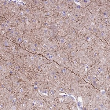 Anti-PIP4K2B antibody produced in rabbit Prestige Antibodies&#174; Powered by Atlas Antibodies, affinity isolated antibody, buffered aqueous glycerol solution