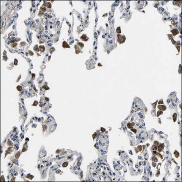 Anti-PLCE1 antibody produced in rabbit Prestige Antibodies&#174; Powered by Atlas Antibodies, affinity isolated antibody, buffered aqueous glycerol solution