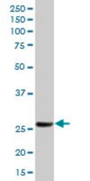 Anti-HPGD antibody produced in mouse purified immunoglobulin, buffered aqueous solution