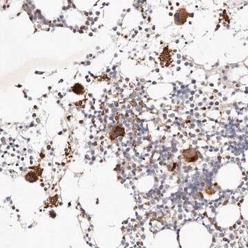 Anti-MTMR11 antibody produced in rabbit Prestige Antibodies&#174; Powered by Atlas Antibodies, affinity isolated antibody, buffered aqueous glycerol solution