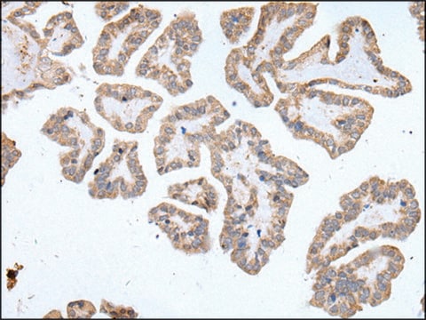 Anti-ABCD1 affinity isolated antibody