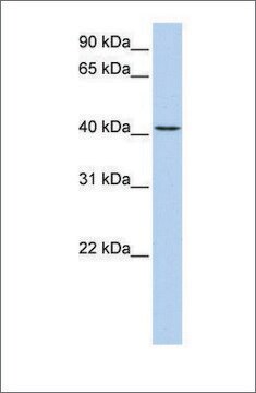 Anti-TMEM144 antibody produced in rabbit affinity isolated antibody