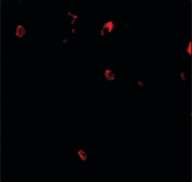 Anti-Cbl antibody produced in rabbit affinity isolated antibody, buffered aqueous solution