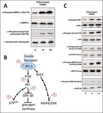 Human Skeletal Muscle Cells: HSkMC: Pre-Screened for Insulin &amp; AMPK signaling, fetal