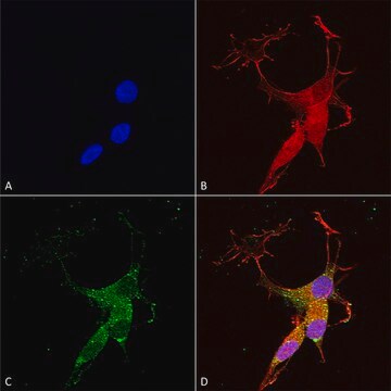 Monoclonal Anti-Copper Transporting Atpase 2 antibody produced in mouse clone S62-29, purified immunoglobulin