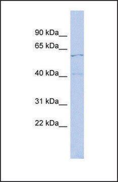 Anti-ZNF384 antibody produced in rabbit affinity isolated antibody