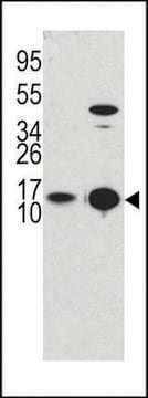 ANTI-LC3 (APG8B) (T6) antibody produced in rabbit affinity isolated antibody, buffered aqueous solution