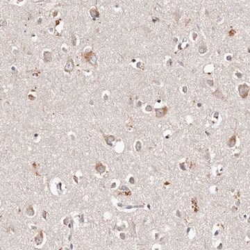 Anti-TSC2 antibody produced in rabbit Prestige Antibodies&#174; Powered by Atlas Antibodies, affinity isolated antibody, buffered aqueous glycerol solution