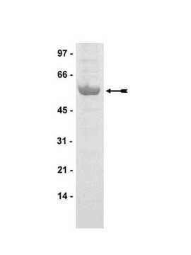 Białko PDK1, aktywne, 10 µg Active, N-terminal, His6-tagged, recombinant human PDK1, amino acids 52-end. For use in Kinase Assays.