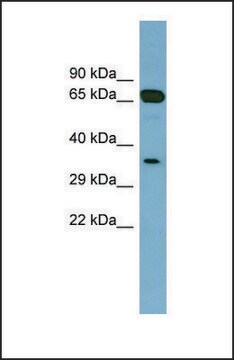 Anti-GLOD4 antibody produced in rabbit affinity isolated antibody