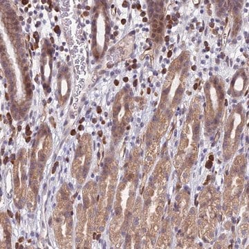 Anti-PPP1R26 antibody produced in rabbit Prestige Antibodies&#174; Powered by Atlas Antibodies, affinity isolated antibody, buffered aqueous glycerol solution