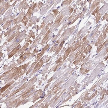 Anti-ST8SIA2 antibody produced in rabbit Prestige Antibodies&#174; Powered by Atlas Antibodies, affinity isolated antibody, buffered aqueous glycerol solution