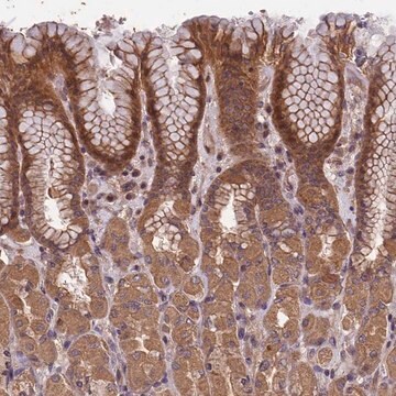 Anti-CHD9 antibody produced in rabbit Prestige Antibodies&#174; Powered by Atlas Antibodies, affinity isolated antibody, buffered aqueous glycerol solution