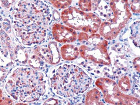 Anti-Dicarbonyl Reductase antibody produced in goat affinity isolated antibody, buffered aqueous solution