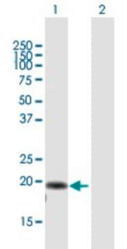 Anti-AP3S2 antibody produced in mouse purified immunoglobulin, buffered aqueous solution