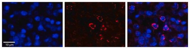 Anti-FANCL antibody produced in rabbit affinity isolated antibody