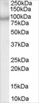 Anti-CENTB2/ACAP2 antibody produced in goat affinity isolated antibody, buffered aqueous solution